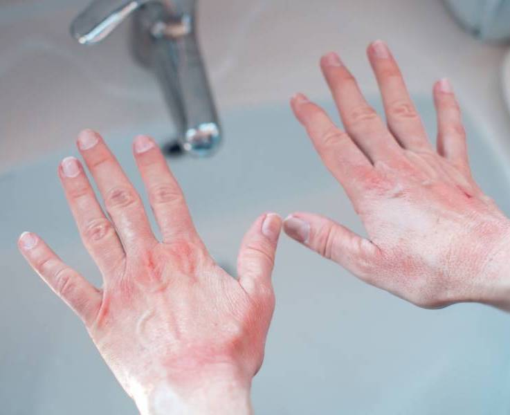 Бытовая химия без вреда: 5 ошибок, которых стоит избегать - Фото: verywellhealth.com